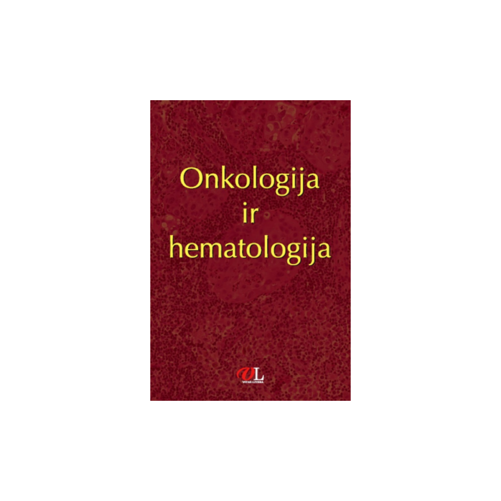 Onkologija ir hematologija