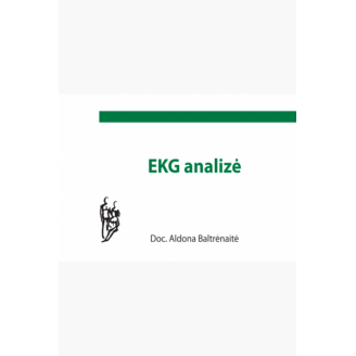EKG analizė